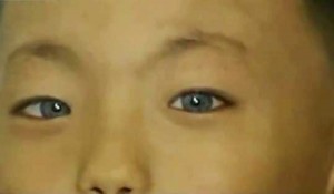 Boy With Cat-Like Eyes Sees In Dark - Mutant, Alien-hybrid or Evolution ...