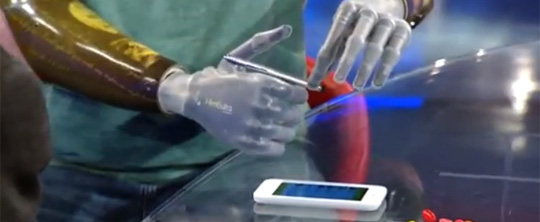 The Man With iPhone-Controlled Bionic Arms