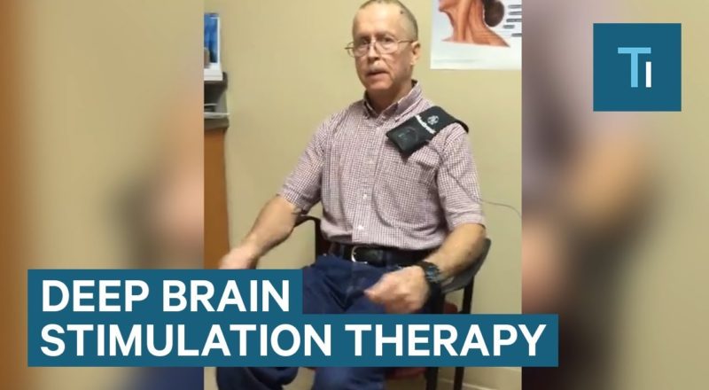 This Device Instantly Calms Symptoms of Parkinson's Disease