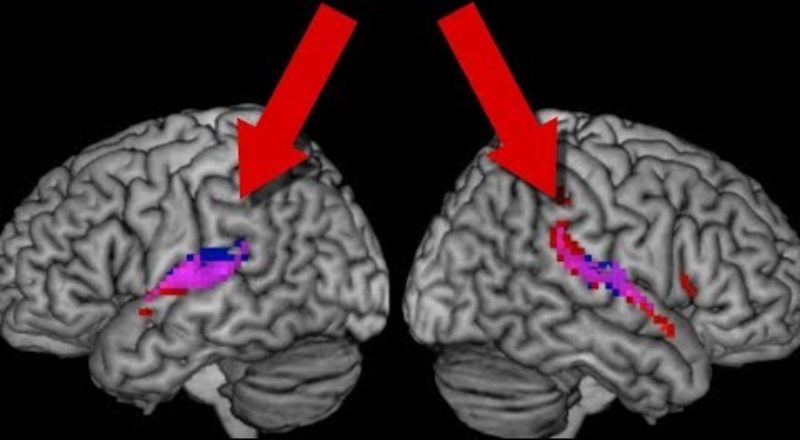 Do Human Brains Synchronise?